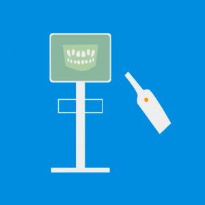 Intraoralscanner